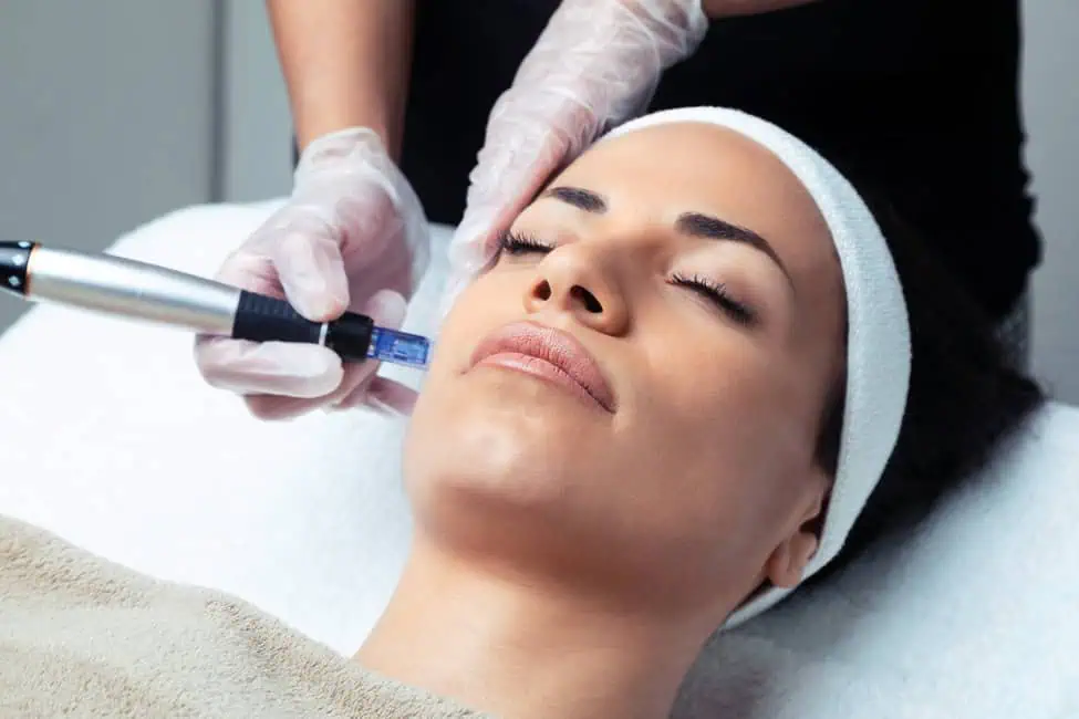 SkinPen Microneedling by The Plump Room LLC in