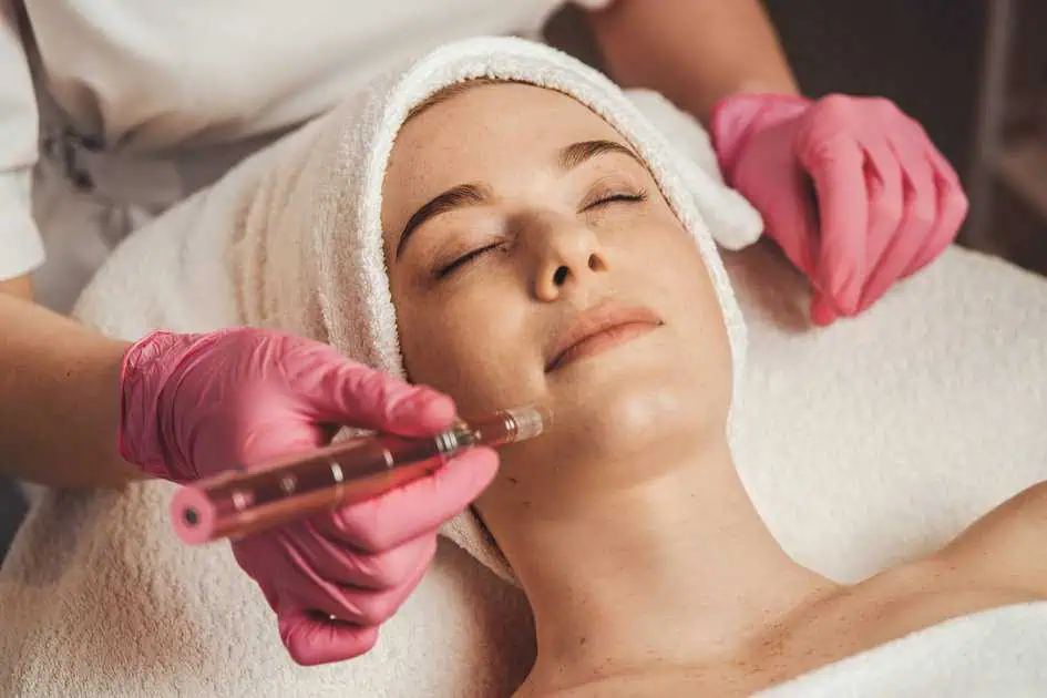 Microneedling Treatment by The Plump Room in Coral Gables, FL