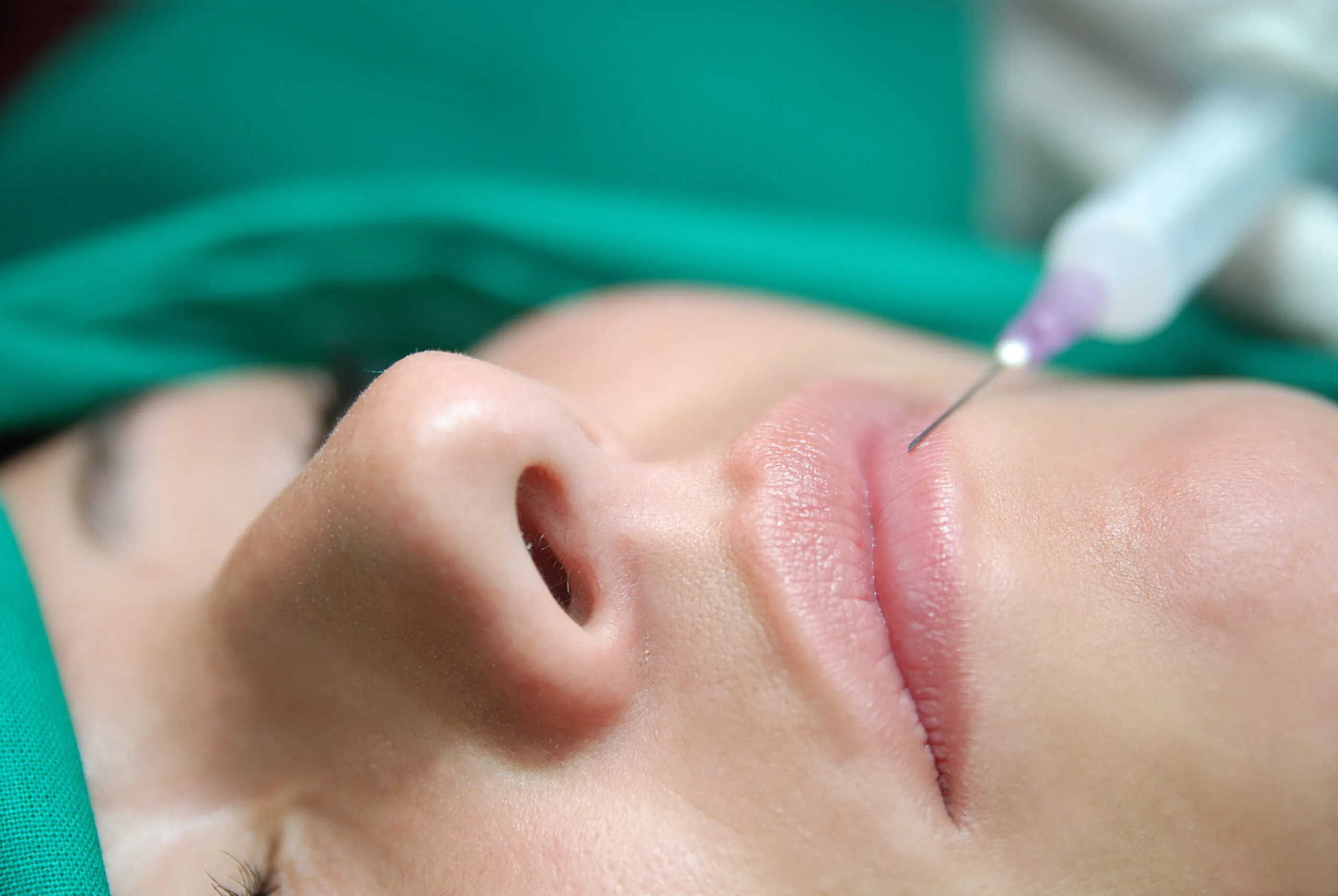 the-plumproommiami-dermal-filler-by-the-plump-room-in-aragon-ave-suite-coral-gables-fl-scaled